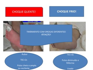 CHOQUE QUENTE!
TRATAMENTO COM DROGAS DIFERENTES!
ATENÇÃO!
Rubor TEC>2s
TEC<2s Pulso diminuído e
filiforme
Pulso cheio e amplo
ou oscilante Livedo
CHOQUE FRIO!
 