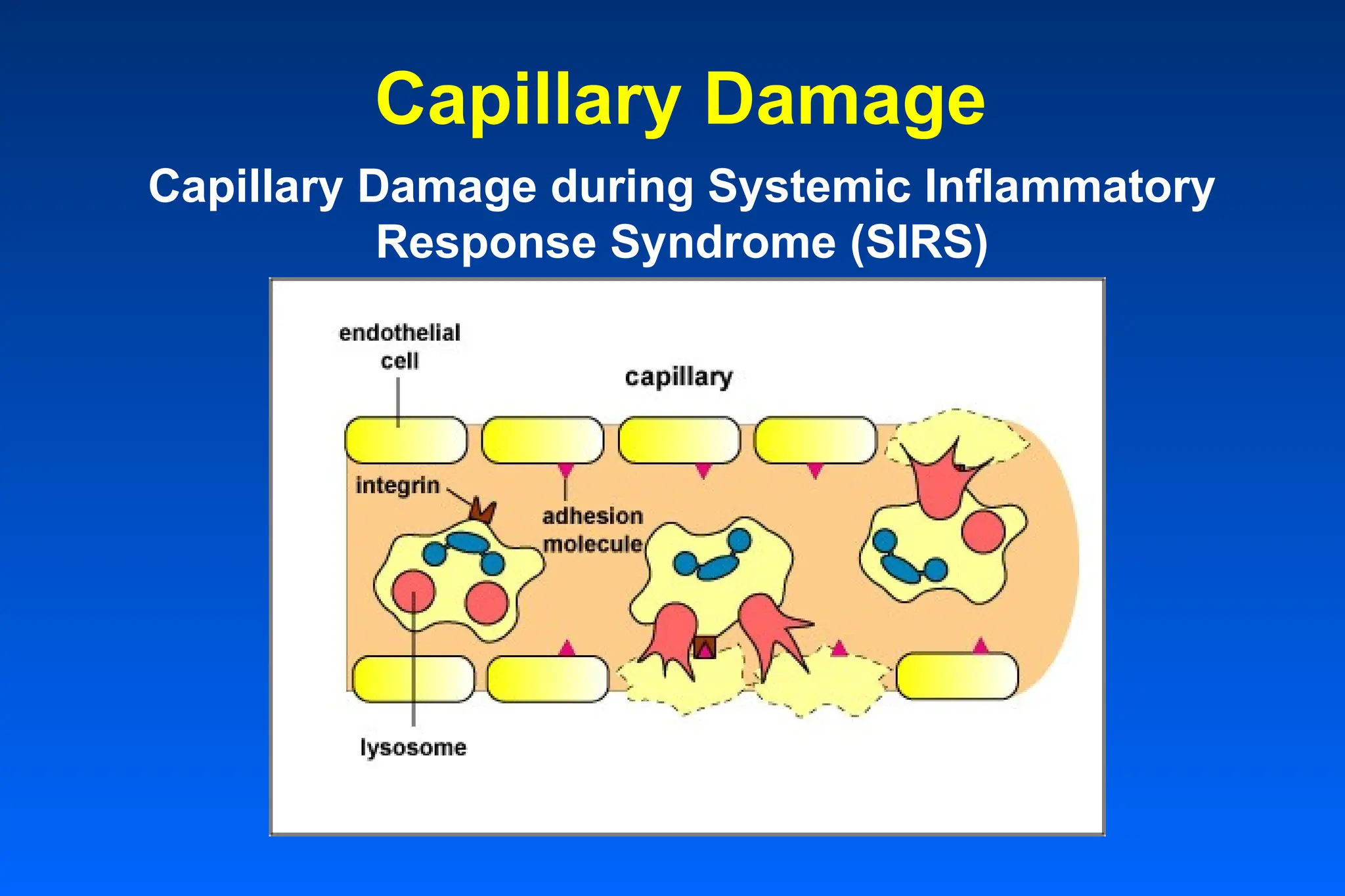 Capillary Damage
Capillary Damage during Systemic Inflammatory
Response Syndrome (SIRS)
 