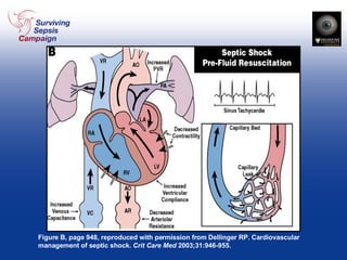 Figure B, page 948, reproduced with permission from Dellinger RP. Cardiovascular management of septic shock.  Crit Care Med  2003;31:946-955. 