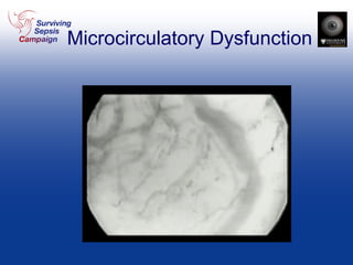 Microcirculatory Dysfunction 