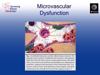 Microvascular Dysfunction 