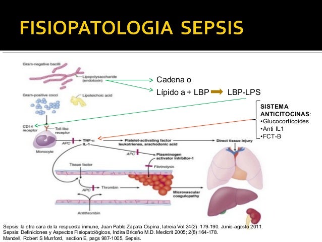 Sepsis