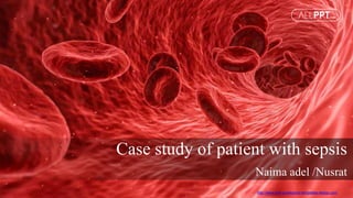 http://www.free-powerpoint-templates-design.com
Case study of patient with sepsis
Naima adel /Nusrat
 