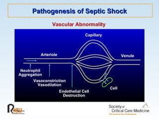 Capillary Vascular   Abnormality Arteriole Neutrophil Aggregation Vasoconstriction Vasodilation Endothelial Cell Destruction Venule Cell Pathogenesis of Septic Shock 