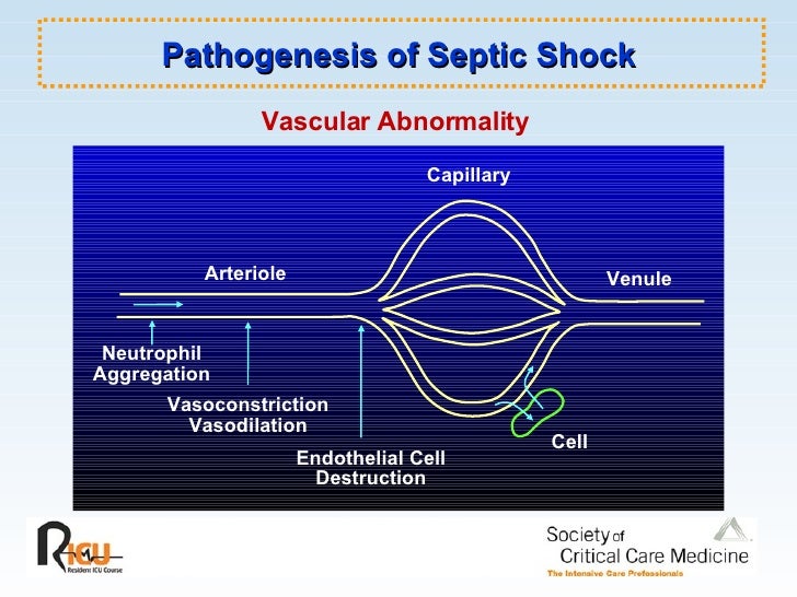 Sepsis And Septic Shock Ppt
