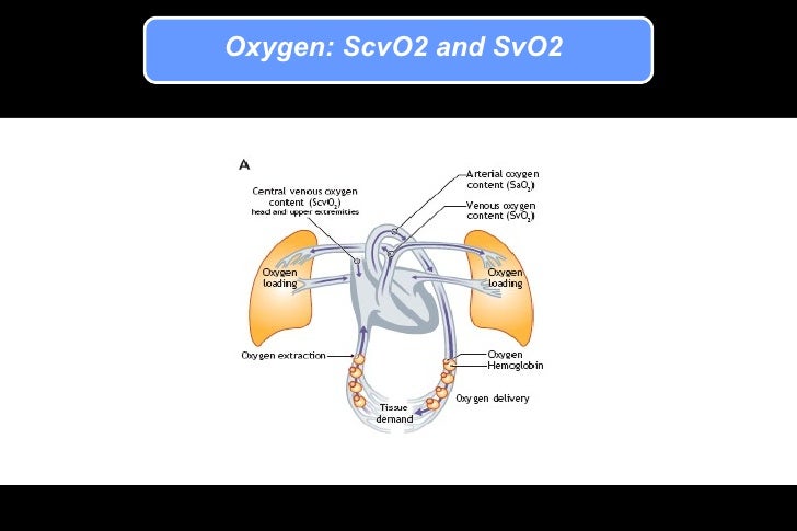 Scvo2 Swan Scvo2 And Sepsis _ Place de la SVO2 dans la prise en charge des états ...