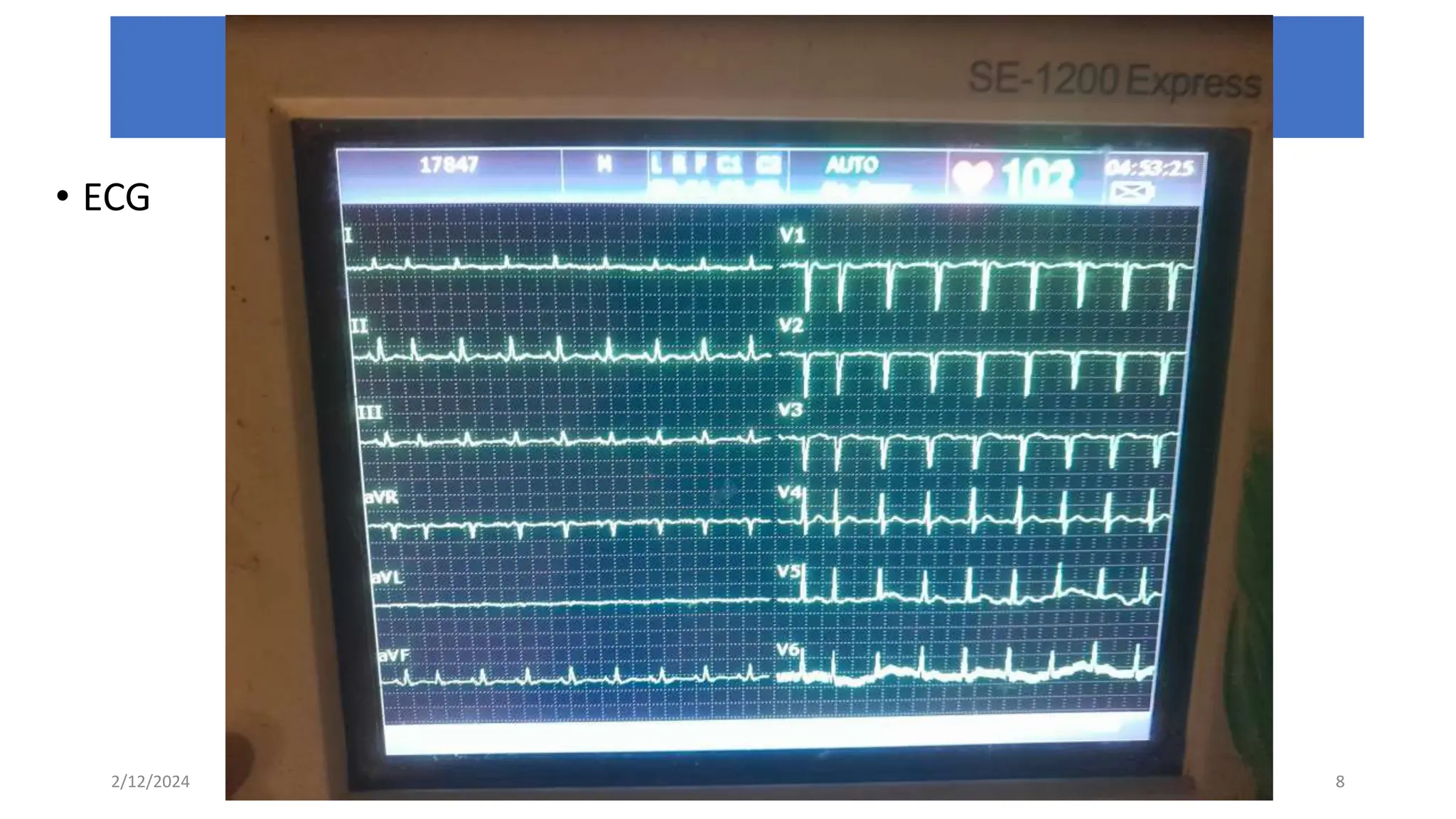• ECG
2/12/2024 HU CHMS SOM Dpt of Internal medicine 8
IMAGINGS
 