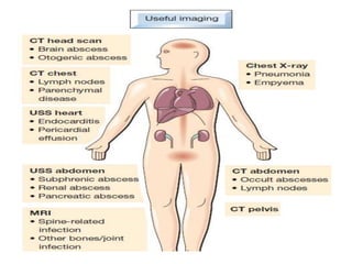 Sirs Diffuse Rash Systemic Inflammatory Response Syndrome SIRS and Septicemia | PPTX