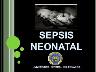 SEPSIS
NEONATAL
UNIVERSIDAD CENTRAL DEL ECUADOR
 