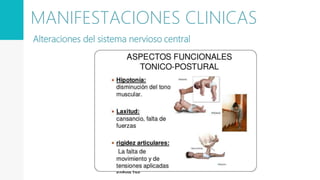 Alteraciones del sistema nervioso central
MANIFESTACIONES CLINICAS
 