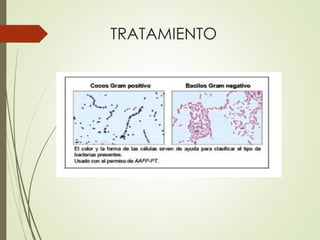 TRATAMIENTO
 