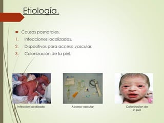 Etiología.
 Causas posnatales.
1. Infecciones localizadas.
2. Dispositivos para acceso vascular.
3. Colonización de la piel.
Acceso vascular Colonizacion de
la piel
Infeccion localizada
 