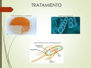 TRATAMIENTO
Cultivo de Streptococcus agalactiae Estreptococos del grupo B
DIBUJO ESQUEMATICO DE LA ESCHERICHIA COLI
 
