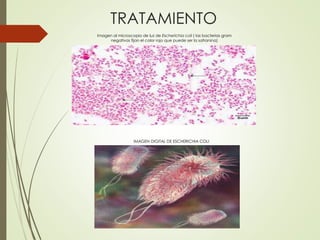 TRATAMIENTO
Imagen al microscopio de luz de Escherichia coli ( las bacterias gram
negativas fijan el color rojo que puede ser la safranina)
IMAGEN DIGITAL DE ESCHERICHIA COLI
 