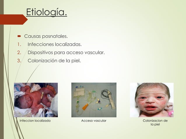 sepsis-neonatal-power-point-ppt