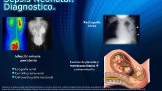 Ecografía renal
Centellograma renal
Cistouretrografía miccional
Infección urinaria
coexistente
Sepsis Neonatal.
Diagnostico.
Radiografía
tórax
Manejo de la sepsis neonatal. Sylvia Martínez Serrano y J. Uberos. Servicio de Pediatría. Hospital Clínico San Cecilio, Granada. Bol. SPAO 2014
Sepsis del recién nacido. B. Fernández Colomer. Servicio de Neonatología. Hospital Universitario Central de Asturias. Asociación Española de Pediatría. Protocolos actualizados al año 2008
Examen de placenta y
membranas fetales 
corioamnionitis
 