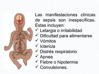 Las manifestaciones clínicas
de sepsis son inespecíficas,
Estas incluyen:
 Letargia o irritabilidad
 Dificultad para alimentarse
 Vómitos
 Ictericia
 Distrés respiratorio
 Apnea
 Fiebre o hipotermia
 Convulsiones.
 