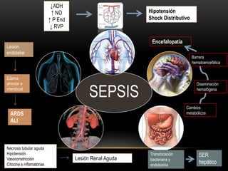 ↓ADH
                            ↑ NO                          Hipotensión
                           ↑ P End                        Shock Distributivo
                            ↓ RVP

                                                           Encefalopatía
Lesión
endotelial
                                                                               Barrera
                                                                               hematoencefálica


Edema
alveolar e

                                           SEPSIS
                                                                                 Diseminación
intersticial                                                                     hematógena



                                                                           Cambios
  ARDS                                                                     metabólicos
  ALI



Necrosis tubular aguda
Hipotensión                                               Translocación            SER
Vasoconstricción                     Lesión Renal Aguda   bacteriana y
Citocina s inflamatorias                                  endotoxina
                                                                                   hepático
 