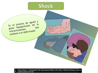Shock
 