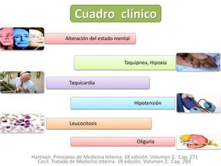 Alteración del estado mental
Taquipnea, Hipoxia
Taquicardia
Hipotensión
Leucocitosis
Oliguria
Cuadro clínico
Harrison. Principios de Medicina Interna. 18 edición. Volumen 2. Cap. 271
Cecil. Tratado de Medicina Interna. 19 edición. Volumen 2. Cap. 288
 