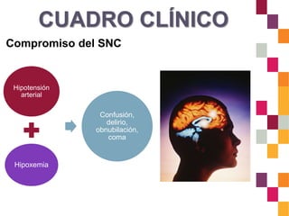 CUADRO CLÍNICO
Compromiso del SNC
Hipotensión
arterial
Hipoxemia
Confusión,
delirio,
obnubilación,
coma
 