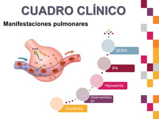 CUADRO CLÍNICO
Manifestaciones pulmonares
Taquipnea
Hiperventilaci
ón
Hipoxemia
IPA
SDRA
 