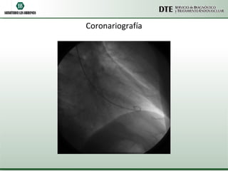 Coronariografía 