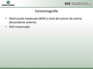 Coronariografía Obstrucción moderada (60%) a nivel del ostium de arteria descendente anterior. FSVI conservada. 