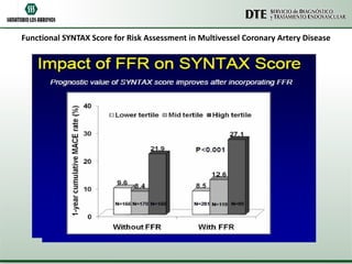 Functional SYNTAX Score for Risk Assessment in Multivessel Coronary Artery Disease 