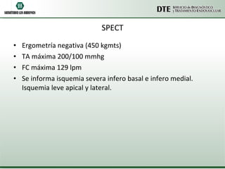 SPECT Ergometría negativa (450 kgmts) TA máxima 200/100 mmhg FC máxima 129 lpm Se informa isquemia severa infero basal e infero medial. Isquemia leve apical y lateral. 