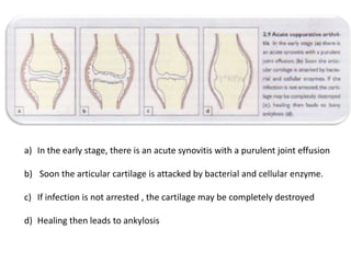 a) In the early stage, there is an acute synovitis with a purulent joint effusion

b) Soon the articular cartilage is attacked by bacterial and cellular enzyme.

c) If infection is not arrested , the cartilage may be completely destroyed

d) Healing then leads to ankylosis
 