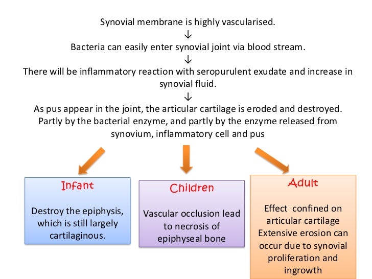 Septic arthritis