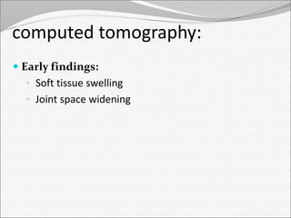 computed tomography: 
 Early findings: 
 Soft tissue swelling 
 Joint space widening 
 