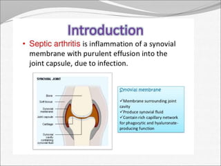 Septic arthritis