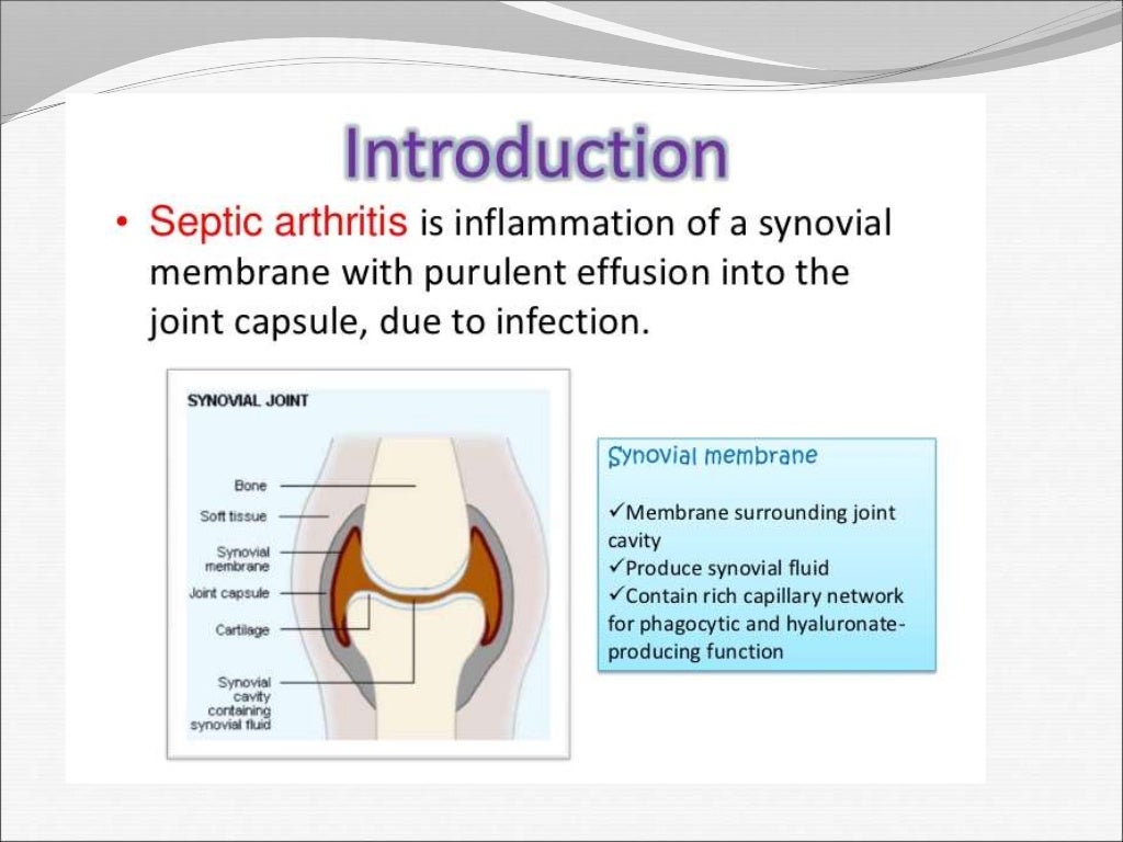 Septic arthritis