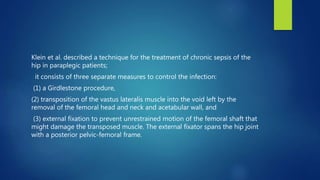Klein et al. described a technique for the treatment of chronic sepsis of the
hip in paraplegic patients;
it consists of three separate measures to control the infection:
(1) a Girdlestone procedure,
(2) transposition of the vastus lateralis muscle into the void left by the
removal of the femoral head and neck and acetabular wall, and
(3) external fixation to prevent unrestrained motion of the femoral shaft that
might damage the transposed muscle. The external fixator spans the hip joint
with a posterior pelvic-femoral frame.
 