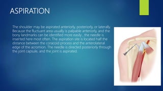 ASPIRATION
The shoulder may be aspirated anteriorly, posteriorly, or laterally.
Because the fluctuant area usually is palpable anteriorly, and the
bony landmarks can be identified more easily , the needle is
inserted here most often. The aspiration site is located half the
distance between the coracoid process and the anterolateral
edge of the acromion. The needle is directed posteriorly through
the joint capsule, and the joint is aspirated.
 