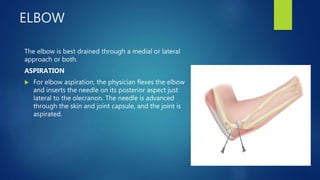 ELBOW
The elbow is best drained through a medial or lateral
approach or both.
ASPIRATION
 For elbow aspiration, the physician flexes the elbow
and inserts the needle on its posterior aspect just
lateral to the olecranon. The needle is advanced
through the skin and joint capsule, and the joint is
aspirated.
 