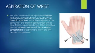 ASPIRATION OF WRIST
 The most common site of aspiration is between
the first and second extensor compartments at
the radiocarpal level, immediately adjacent to the
point where the extensor pollicis longus crosses
the extensor carpi radialis longus. Other aspiration
sites are between the third and fourth extensor
compartments or between the fourth and fifth
extensor compartments
 