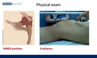 Septic arthritis | PPTX