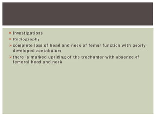  Investigations
 Radiography
complete loss of head and neck of femur function with poorly
developed acetabulum
there is marked upriding of the trochanter with absence of
femoral head and neck
 