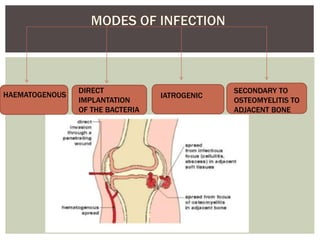 HAEMATOGENOUS
DIRECT
IMPLANTATION
OF THE BACTERIA
IATROGENIC
SECONDARY TO
OSTEOMYELITIS TO
ADJACENT BONE
 