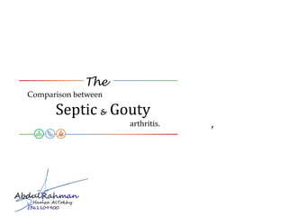 The
Objective
15 – 20 min 25 Slides May 09, 2017
Comparison between
Septic & Gouty
arthritis.
 