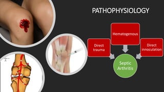 PATHOPHYSIOLOGY
Septic
Arthritis
Direct
trauma
Hematogenous
Direct
innoculation
 