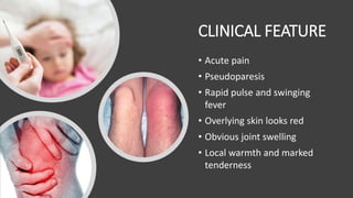 CLINICAL FEATURE
• Acute pain
• Pseudoparesis
• Rapid pulse and swinging
fever
• Overlying skin looks red
• Obvious joint swelling
• Local warmth and marked
tenderness
 