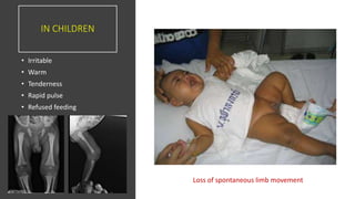 IN CHILDREN
• Irritable
• Warm
• Tenderness
• Rapid pulse
• Refused feeding
Loss of spontaneous limb movement
 