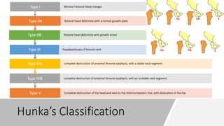 Hunka’s Classification
Type V Complete destruction of the head and neck to the intertrochanteric line, with dislocation of the hip
Type IVB complete destruction of proximal femoral epiphysis, with an unstable neck segment.
Type IVA complete destruction of proximal femoral epiphysis, with a stable neck segment.
Type III Pseudoarthrosis of femoral neck
Type IIB femoral head deformity with growth arrest
Type IIA femoral head deformity with a normal growth plate
Type I Minimal Femoral Head changes
 