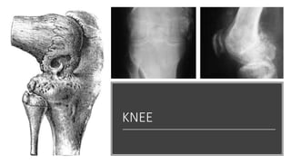 KNEE
 