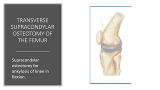TRANSVERSE
SUPRACONDYLAR
OSTEOTOMY OF
THE FEMUR
Supracondylar
osteotomy for
ankylosis of knee in
flexion.
 