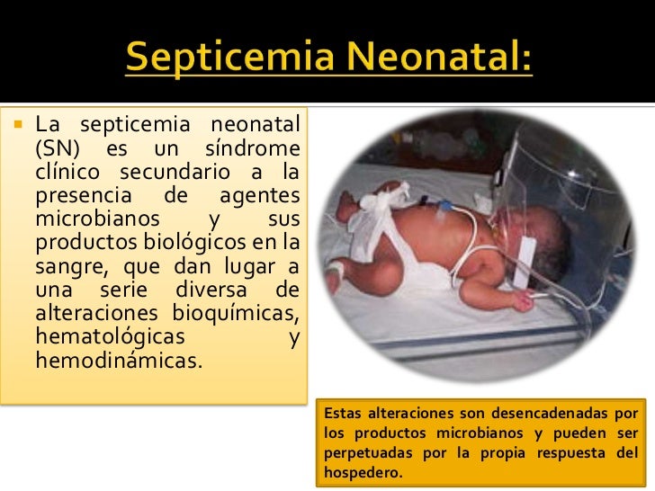Dissertation neonatal septicemia